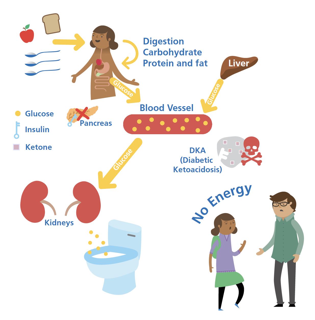 What is Diabetes - The Glucose Never Lies