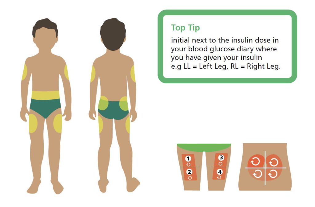 Bolus Insulin The Glucose Never Lies